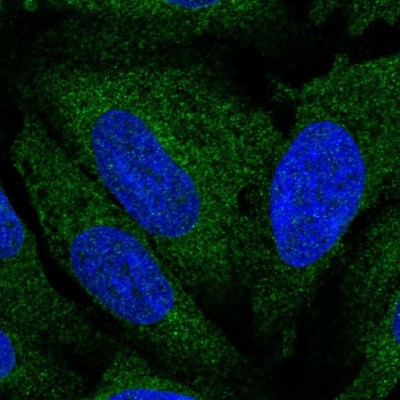 Immunocytochemistry/Immunofluorescence: Atlastin-3 Antibody [NBP2-56000] - Staining of human cell line U-2 OS shows localization to endoplasmic reticulum.