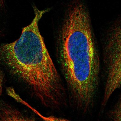 Immunocytochemistry/Immunofluorescence: AFTPH Antibody [NBP1-82209] - Immunofluorescent staining of human cell line U-2 OS shows localization to cytosol, the Golgi apparatus & vesicles.