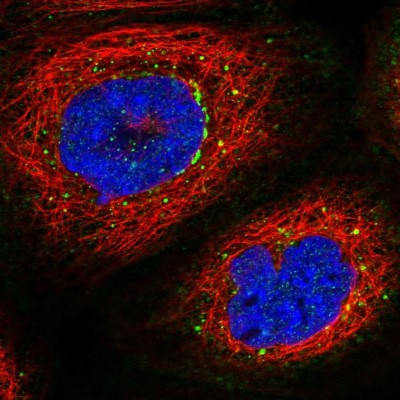 Immunocytochemistry/Immunofluorescence: PRMT10 Antibody [NBP1-81887] - Staining of human cell line A-431 shows positivity in vesicles.