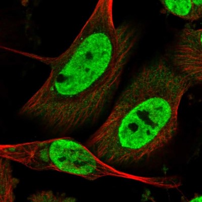 Immunocytochemistry/Immunofluorescence: LIN9 Antibody [NBP1-80690] - Immunofluorescent staining of human cell line U-251 MG shows localization to nucleoplasm.