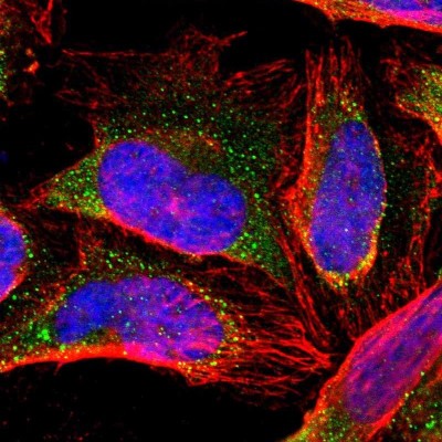 Immunocytochemistry/Immunofluorescence: ZNF133 Antibody [NBP1-80914] - Immunofluorescent staining of human cell line U-2 OS shows localization to vesicles.