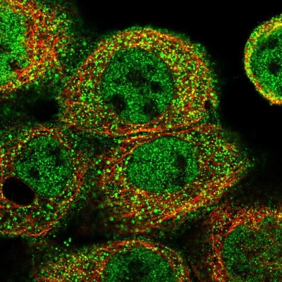 Immunocytochemistry/Immunofluorescence: ACOX1 Antibody [NBP1-80951] - Immunofluorescent staining of human cell line A-431 shows localization to nucleoplasm, plasma membrane & vesicles.