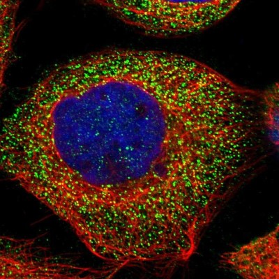 Immunocytochemistry/Immunofluorescence: DOLPP1 Antibody [NBP1-81286] - Immunofluorescent staining of human cell line A-431 shows localization to vesicles.