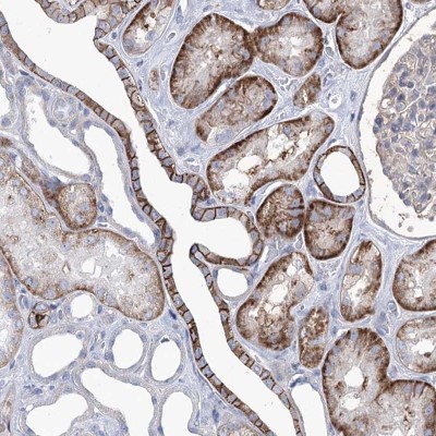 Immunocytochemistry/Immunofluorescence: CEP164 Antibody [NBP1-81446] - Staining of human kidney shows cytoplasmic and membranous positivity in cells in tubules.
