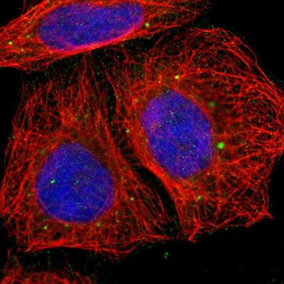 Immunocytochemistry/Immunofluorescence: ZNF229 Antibody [NBP1-86175] - Staining  of human cell line A-431 shows positivity in vesicles.