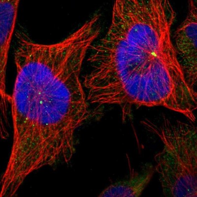 Immunocytochemistry/Immunofluorescence: CNTROB Antibody [NBP1-82835] - Immunofluorescent staining of human cell line U-251 MG shows localization to cytosol & centrosome.