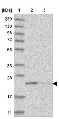 Western Blot: C1orf110 Antibody [NBP1-82672] - Lane 1: Marker  [kDa] 230, 130, 95, 72, 56, 36, 28, 17, 11.  Lane 2: Human cell line RT-4.  Lane 3: Human cell line U-251MG sp