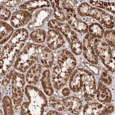 Immunohistochemistry-Paraffin: C1orf110 Antibody [NBP1-82672] - Staining of human kidney shows strong granular cytoplasmic positivity in tubule cells.