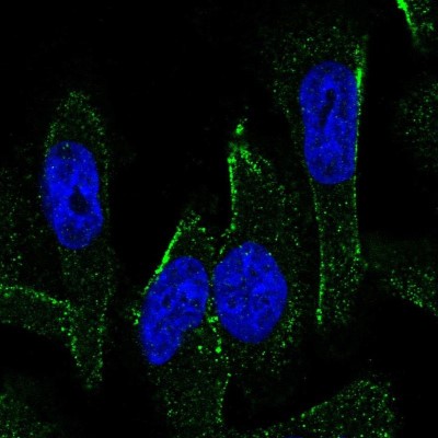 Immunocytochemistry/Immunofluorescence: MEX3C Antibody [NBP1-81932] - Immunofluorescent staining of human cell line U-251 MG shows localization to vesicles.