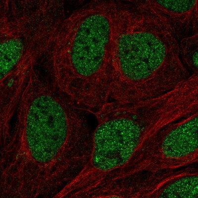 Immunocytochemistry/Immunofluorescence: TFCP2 Antibody [NBP2-55972] - Staining of human cell line U-2 OS shows localization to nucleoplasm.