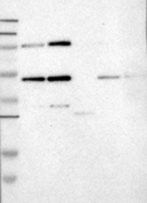 Western Blot: cleavage stimulation factor Antibody [27150002] - Samples:  Lane 1, Marker [kDa]: 250, 130, 95, 72, 55, 36, 28, 17, 11  Lane 2, RT-4 Lane 3, U-251MG sp Lane 4, Human Plasma Lane 5, Liver Lane 6, Tonsil      Target weight [kDa]:  48       Validation score:  2   Validation description:  Supportive - Band of predicted size in kDa (+/-20%) with additional bands present.