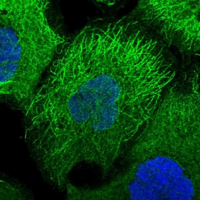 Immunocytochemistry/Immunofluorescence: DMRTA2 Antibody [NBP1-85830] - Staining  of human cell line A-431 shows positivity in cytoplasm and cytoskeleton (microtubules).