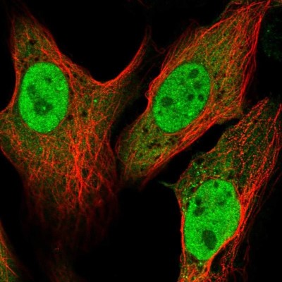 Immunocytochemistry/Immunofluorescence: ATP6V1C1 Antibody [NBP2-58586] - Staining of human cell line U-2 OS shows localization to nucleoplasm & cytosol.