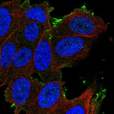 Immunocytochemistry/Immunofluorescence: SLCO1A2 Antibody [NBP2-56965] - Staining of human cell line SH-SY5Y shows localization to plasma membrane.