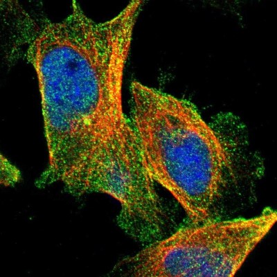 Immunocytochemistry/Immunofluorescence: Carboxypeptidase A4/CPA4 Antibody [NBP1-85494] - Immunofluorescent staining of human cell line U-251 MG shows localization to nucleoplasm, cytosol & centrosome.