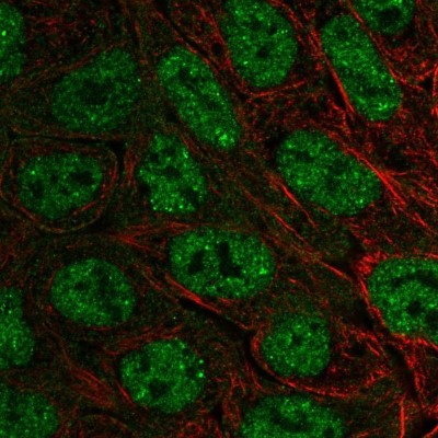 Immunocytochemistry/Immunofluorescence: EXOC6B Antibody [NBP2-56692] - Staining of human cell line RT4 shows localization to nucleoplasm, nuclear bodies & cytosol.