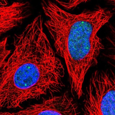 Immunocytochemistry/Immunofluorescence: TOE1 Antibody [NBP2-56752] - Staining of human cell line HeLa shows localization to nucleoplasm & nuclear bodies.