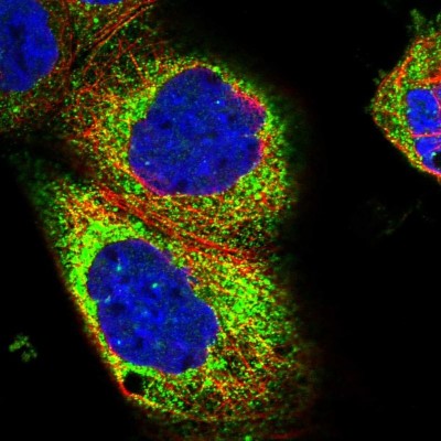 Immunocytochemistry/Immunofluorescence: C15orf26 Antibody [NBP2-14378] - Staining of human cell line A-431 shows positivity in cytoplasm.