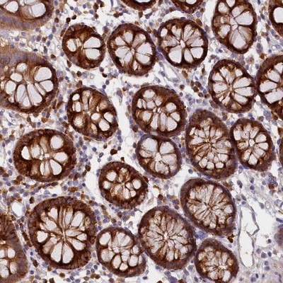 Immunohistochemistry-Paraffin: C15orf26 Antibody [NBP2-14378] - Staining of human colon shows strong cytoplasmic positivity in glandular cells.