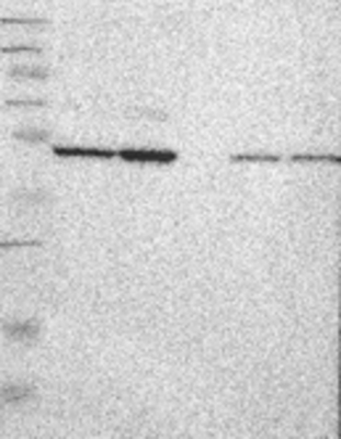 Western Blot: ARHGAP22 Antibody [30180002] - Samples:  Lane 1, Marker [kDa]: 250, 130, 95, 72, 55, 36, 28, 17, 11  Lane 2, RT-4 Lane 3, U-251MG sp  Lane 4, Human Plasma  Lane 5, Liver  Lane 6, Tonsil,  Target weight [kDa]:  77, 64, 59 (splice variants)   Validation score:  1   Validation description:  Supportive - Single band corresponding to the predicted size in kDa (+/-20%).