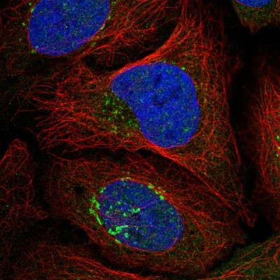 Immunocytochemistry/Immunofluorescence: RASGRF1 Antibody [NBP1-85727] - Immunofluorescent staining of human cell line U-2 OS shows localization to nuclear speckles & the Golgi apparatus.