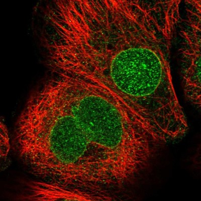 Immunocytochemistry/Immunofluorescence: CDS1 Antibody [NBP1-85894] - Immunofluorescent staining of human cell line A-431 shows localization to nucleus & nuclear membrane.