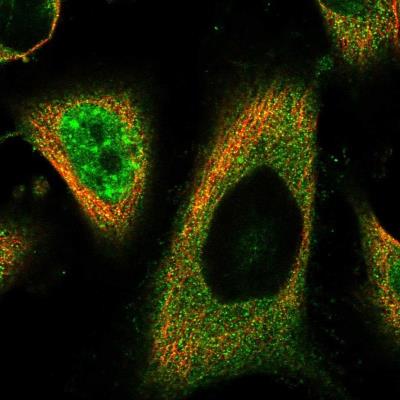 Immunocytochemistry/Immunofluorescence: TIGD3 Antibody [NBP1-85854] - Staining  of human cell line U-251 MG shows positivity in nucleus but not nucleoli, plasma membrane and cytoplasm.