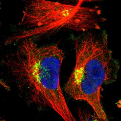 Immunocytochemistry/Immunofluorescence: Eps8 Antibody [NBP1-86150] - Immunofluorescent staining of human cell line U-251 MG shows localization to the Golgi apparatus.