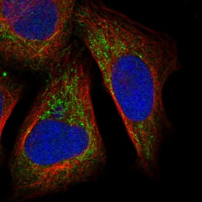 Immunocytochemistry/Immunofluorescence: DHX30 Antibody [NBP1-85270] - Immunofluorescent staining of human cell line U-2 OS shows localization to mitochondria.