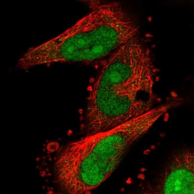 Immunocytochemistry/Immunofluorescence: FAM193B Antibody [NBP1-90436] - Immunofluorescent staining of human cell line U-251 MG shows localization to nucleus & nucleoli.