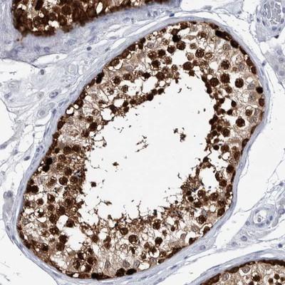 Immunohistochemistry-Paraffin: C9orf150 Antibody [NBP1-90796] - Staining of human testis shows strong cytoplasmic positivity in cells of seminiferus ducts.