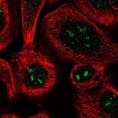 Immunocytochemistry/Immunofluorescence: LRRC14B Antibody [NBP1-90992] - Staining of human cell line A-431 shows positivity in nucleoli.