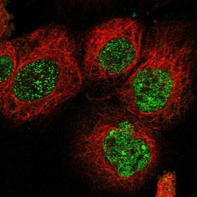 Immunocytochemistry/Immunofluorescence: C21orf58 Antibody [NBP1-85912] - Staining of human cell line A-431 shows localization to nucleoplasm & nuclear bodies.