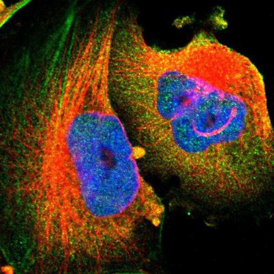 Immunocytochemistry/Immunofluorescence: NXF5 Antibody [NBP1-85809] - Staining of human cell line U-251MG shows positivity in nucleus but not nucleoli, cytoplasm and cytoskeleton (actin filaments).