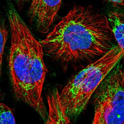 Immunocytochemistry/Immunofluorescence: ABCB8 Antibody [NBP1-91643] - Immunofluorescent staining of human cell line U-251 MG shows localization to nucleus & mitochondria.