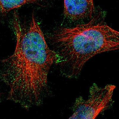 Immunocytochemistry/Immunofluorescence: DHRS7B Antibody [NBP1-85648] - Immunofluorescent staining of human cell line U-251 MG shows localization to nucleoplasm, cytosol & cell junctions.