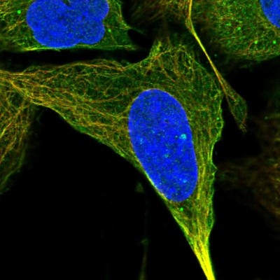 Immunocytochemistry/Immunofluorescence: PRDM15 Antibody [NBP1-86816] - Staining  of human cell line U-2 OS shows positivity in vesicles and cytoskeleton (microtubules).