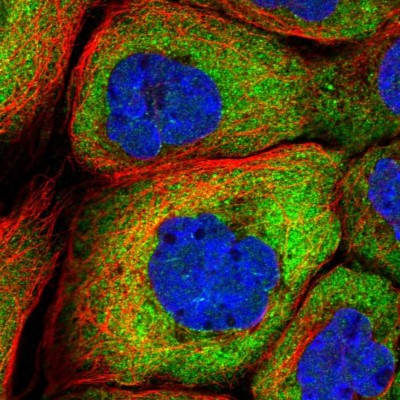 Immunocytochemistry/Immunofluorescence: DBPA Antibody [NBP1-88049] - Immunofluorescent staining of human cell line A-431 shows localization to cytosol.
