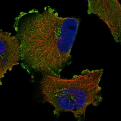Immunocytochemistry/Immunofluorescence: RNF207 Antibody [NBP1-88495] - Staining of human cell line U-251MG shows positivity in plasma membrane and golgi apparatus.
