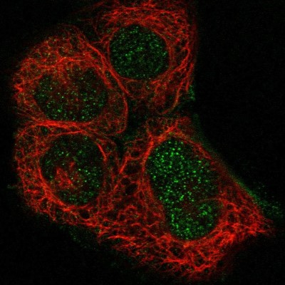 Immunocytochemistry/Immunofluorescence: B3GNT7 Antibody [NBP1-88659] - Staining of human cell line A-431 shows positivity in nucleus but not nucleoli.