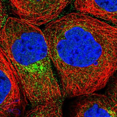 Immunocytochemistry/Immunofluorescence: CPEB4 Antibody [NBP1-81384] - Immunofluorescent staining of human cell line A-431 shows localization to nucleoplasm & vesicles.