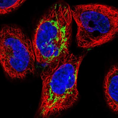 Immunocytochemistry/Immunofluorescence: ALDH1L2 Antibody [NBP1-81935] - Immunofluorescent staining of human cell line A-431 shows localization to mitochondria.