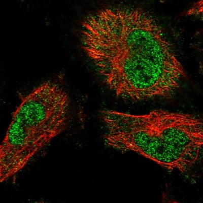 Immunocytochemistry/Immunofluorescence: TRAFD1 Antibody [NBP1-81875] - Immunofluorescent staining of human cell line U-251 MG shows localization to nucleoplasm & cytosol.
