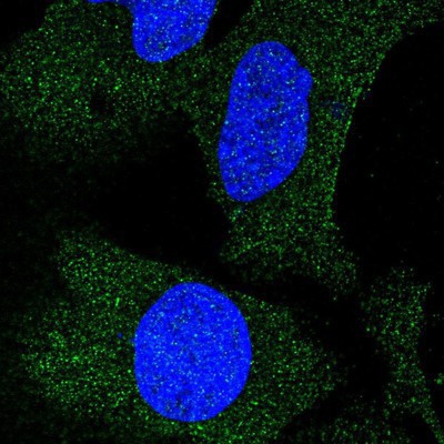 Immunocytochemistry/Immunofluorescence: GPR123 Antibody [NBP1-82890] - Staining of human cell line U-2 OS shows positivity in plasma membrane and cytoplasm.
