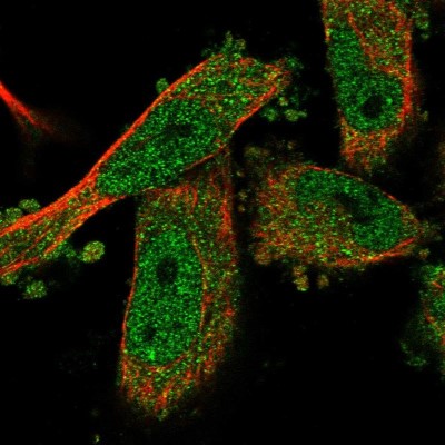 Immunocytochemistry/Immunofluorescence: ARRDC4 Antibody [NBP1-81958] - Staining of human cell line U-251 MG shows positivity in nucleus but not nucleoli and cytoplasm.