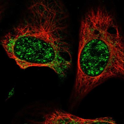 Immunocytochemistry/Immunofluorescence: GCAT Antibody [NBP1-81564] - Staining of human cell line U-2 OS shows localization to nuclear speckles & mitochondria.