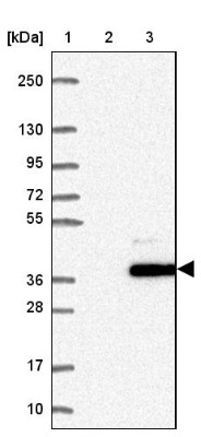 Western Blot: C1orf110 Antibody [NBP1-82674] - Lane 1: Marker [kDa] 250, 130, 95, 72, 55, 36, 28, 17, 10Lane 2: Negative control (vector only transfected HEK293T lysate)Lane 3: Over-expression lysate (Co-expressed with a C-terminal myc-DDK tag (~3.1 kDa) in mammalian HEK293T cells)