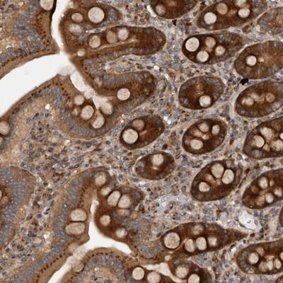 Immunohistochemistry: C1orf110 Antibody [NBP1-82674] - Staining of human duodenum shows strong cytoplasmic positivity in glandular cells.