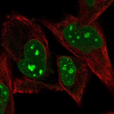 Immunocytochemistry/Immunofluorescence: PRDM5 Antibody [NBP2-13810] - Staining of human cell line RH-30 shows localization to nucleus, nucleoli & nuclear bodies.