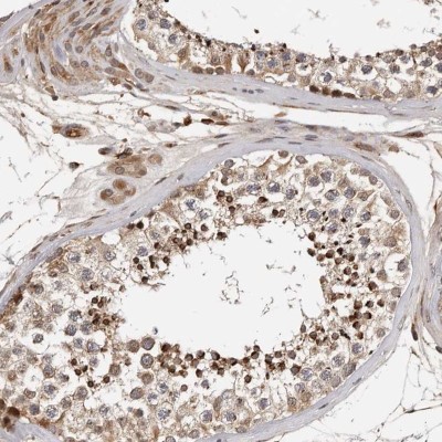 Immunocytochemistry/Immunofluorescence: RNF157 Antibody [NBP1-81360] - Staining of human testis shows strong positivity in seminiferous ducts.